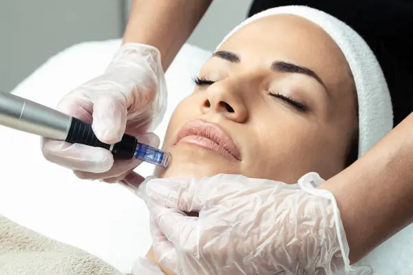 Microneedling
