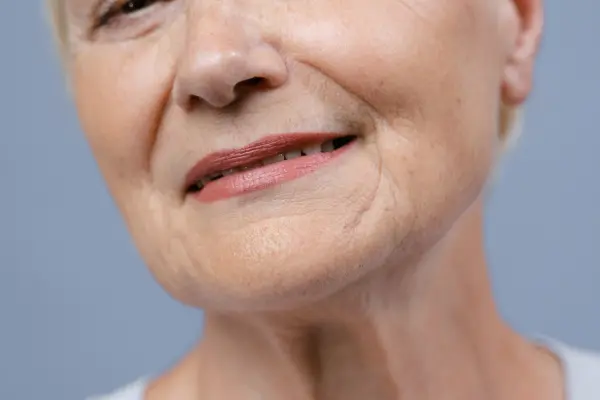 Aging