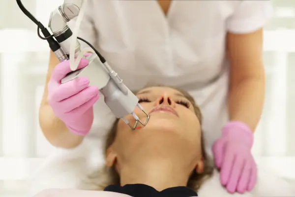 Fractional CO2 Laser treatment in pune