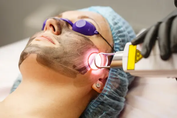 ND-yag-laser-treatment-in-pune