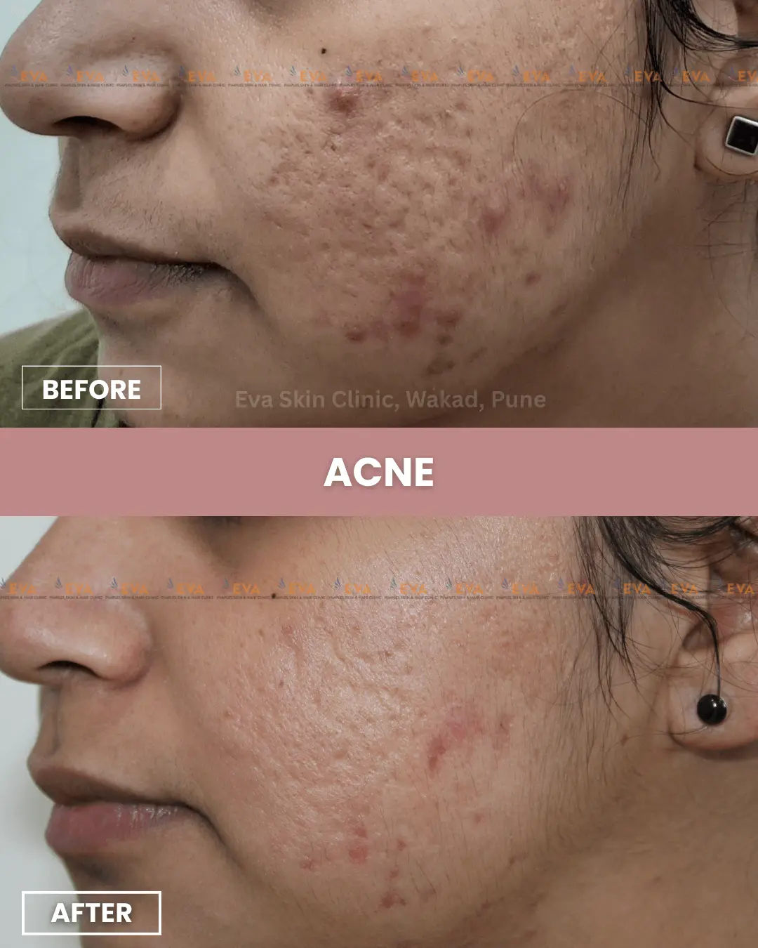 best-dermatologist-in-wakad