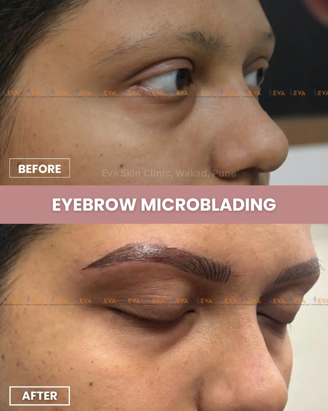 best-eyebrow-microblading-results