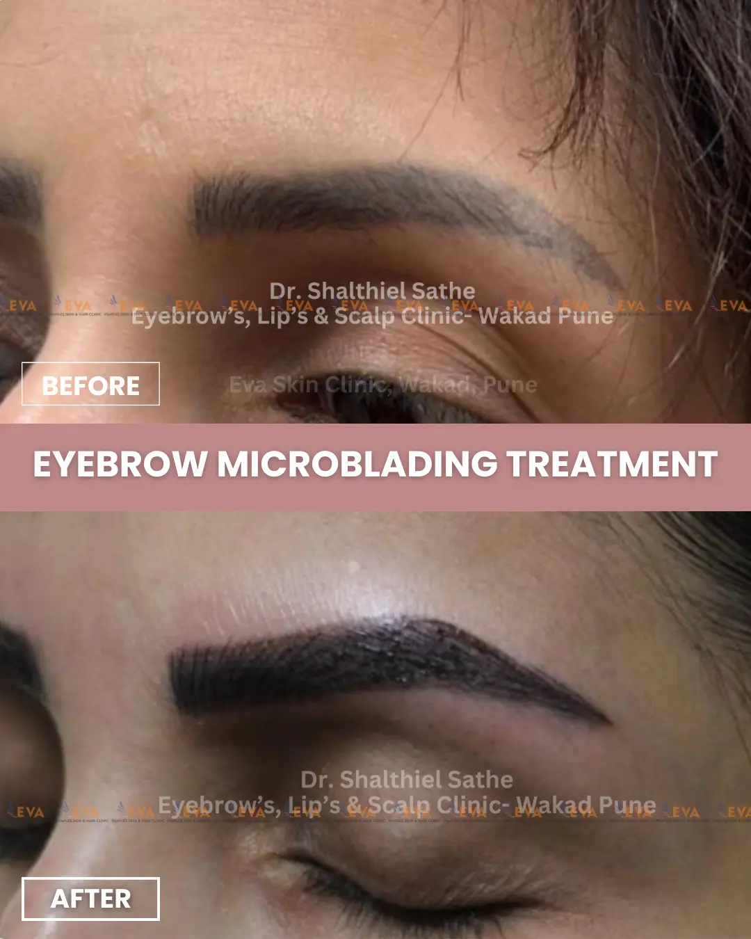 best-eyebrow-microblading-treatment-results