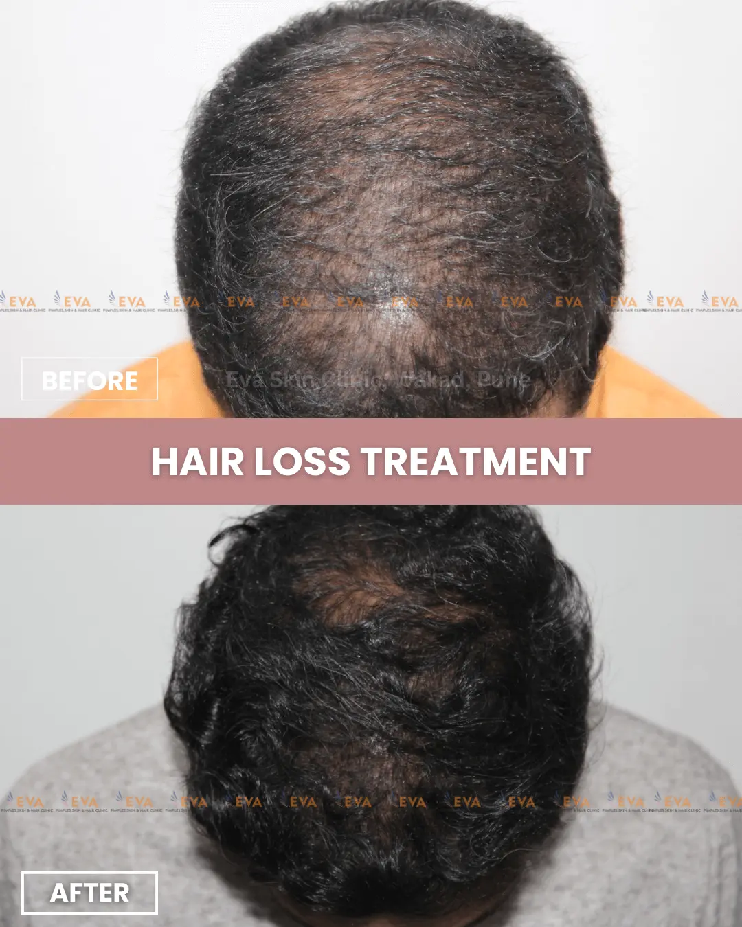 best-hair-doctor