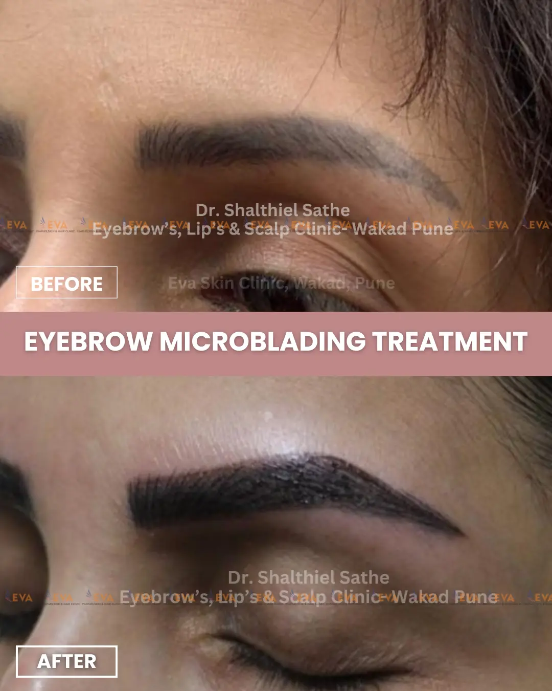 eyebrow-microblading-before-after-results