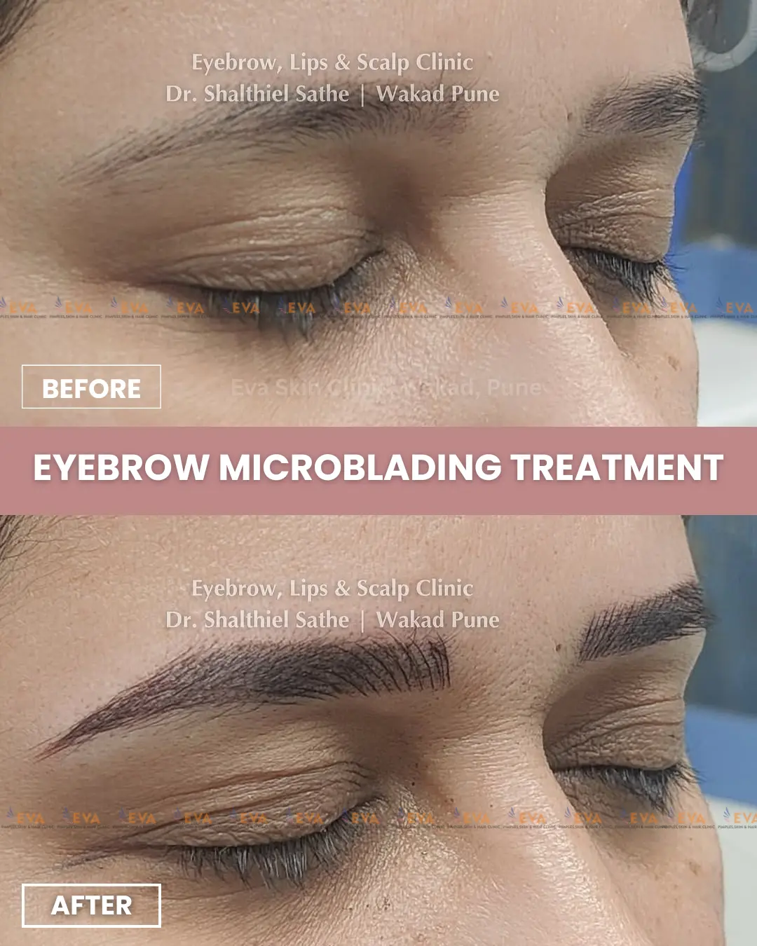 eyebrow-microblading-results-in-pune