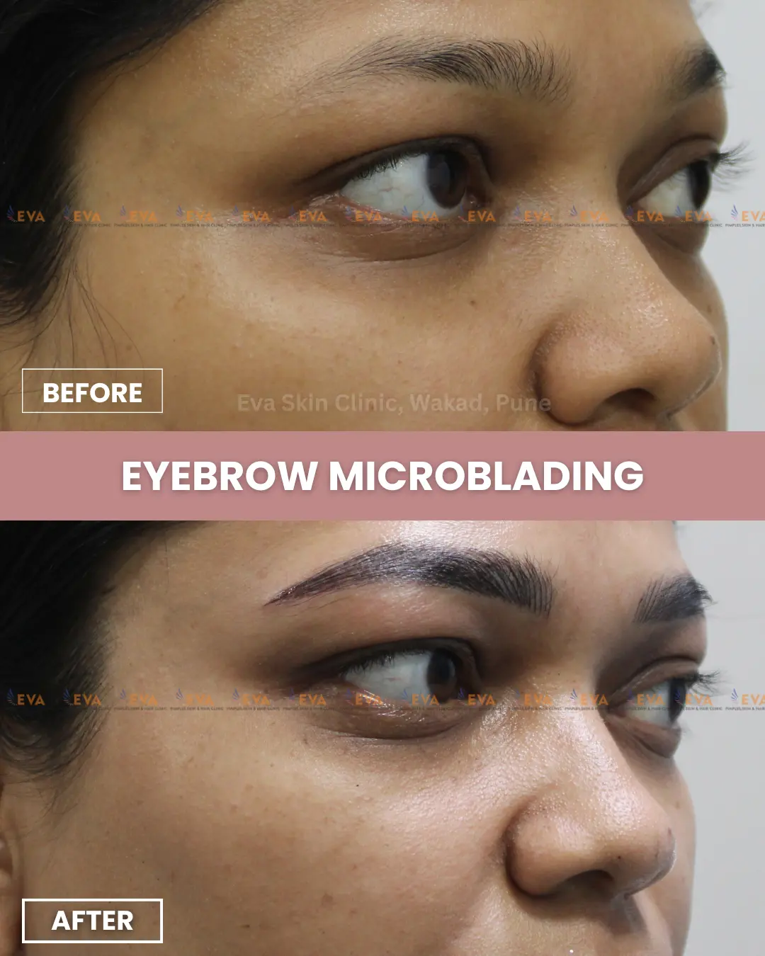 eyebrow-microblading-results-pune