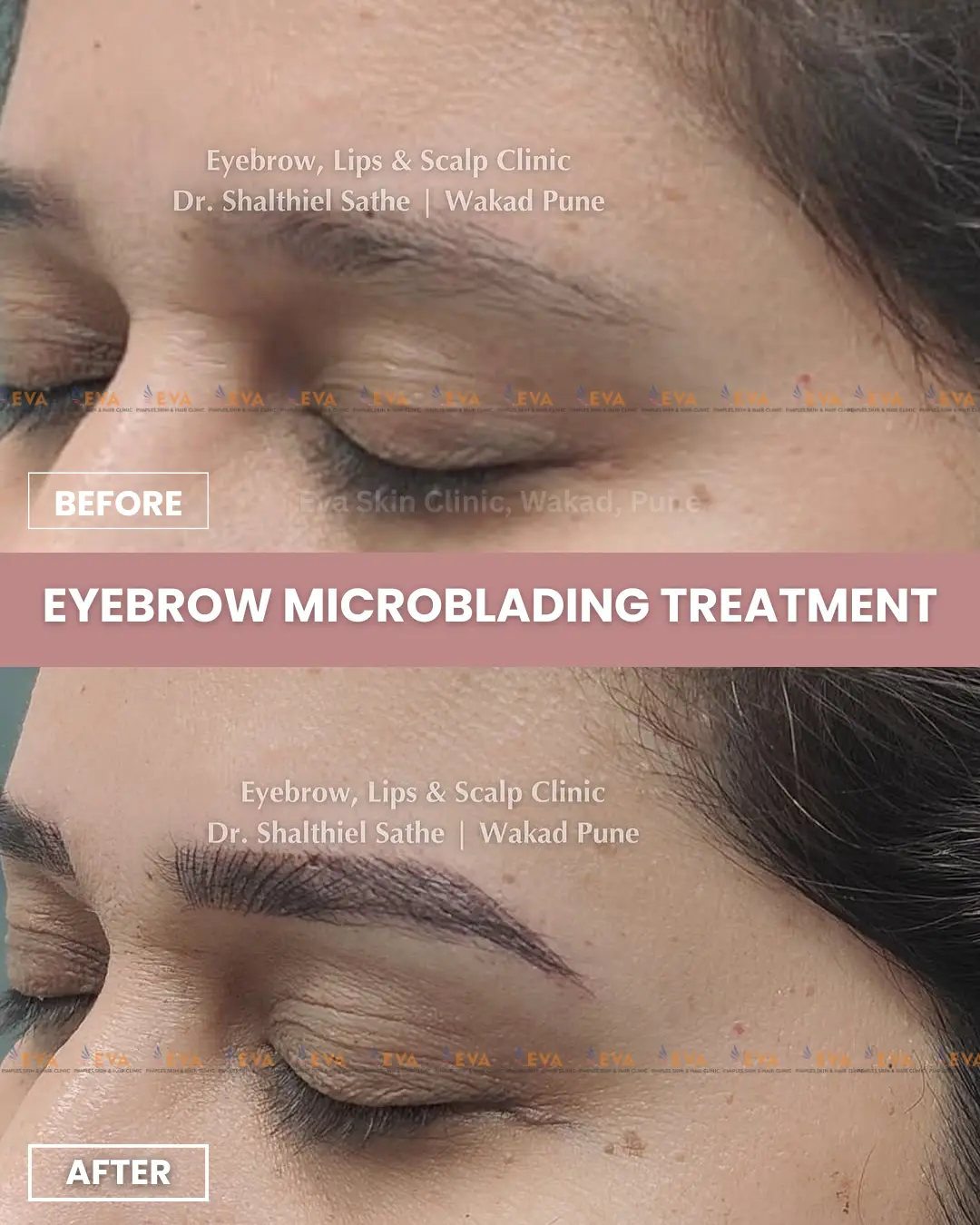 eyebrow-microblading-results