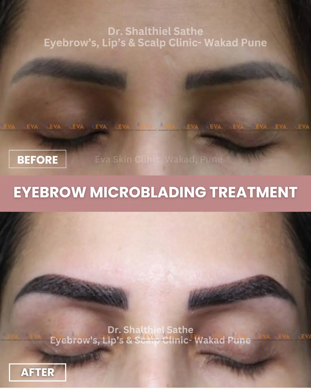 eyebrow-microblading