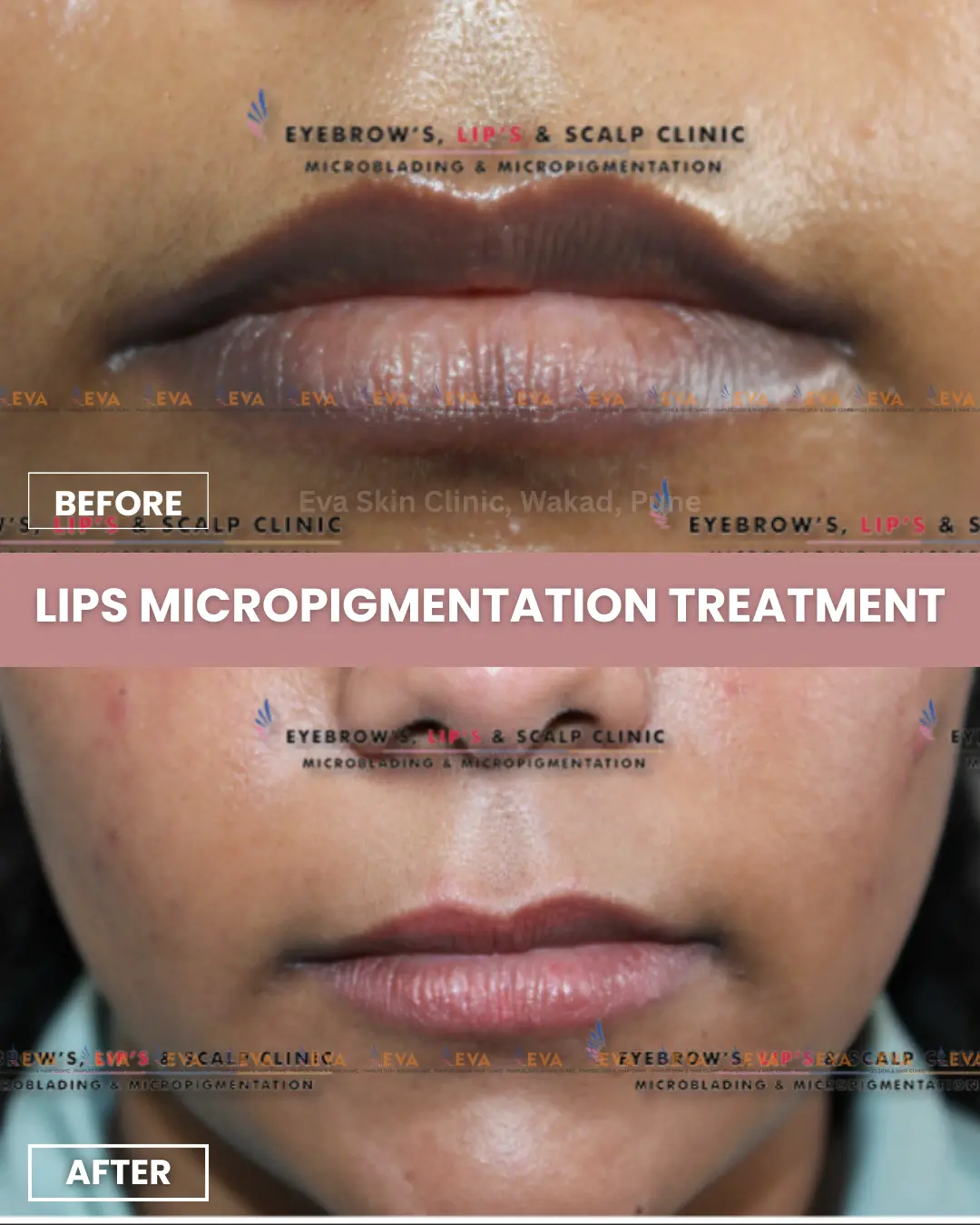 lips-micropigmentation-results
