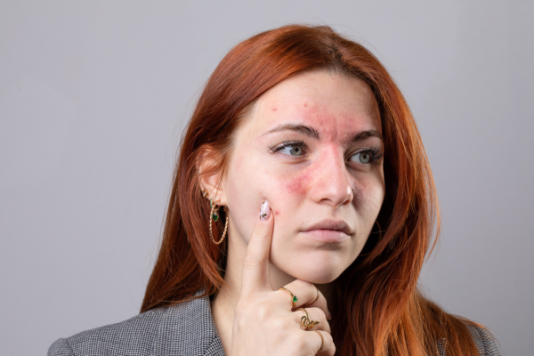 skin-irritatation