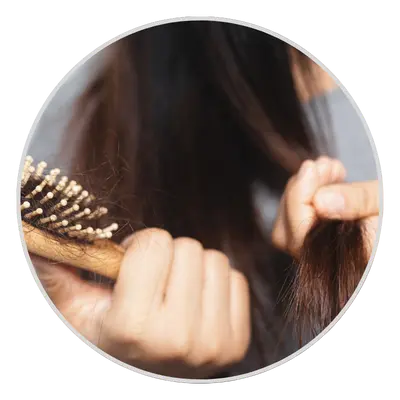 Hair Loss