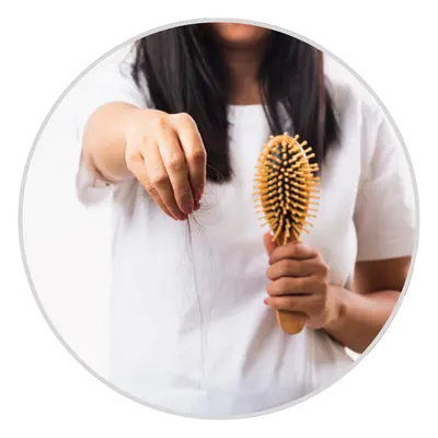 Excessive Hair Fall