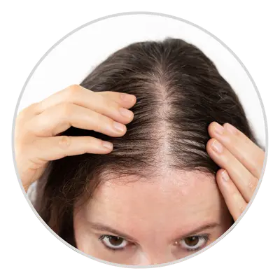 Gradual Thinning on the Crown