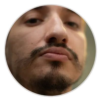 Patchy or Uneven Beard Growth