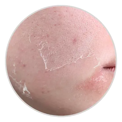 Dull Skin