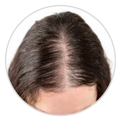 dense hairs