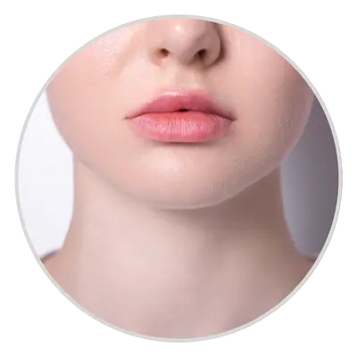 Uneven lips