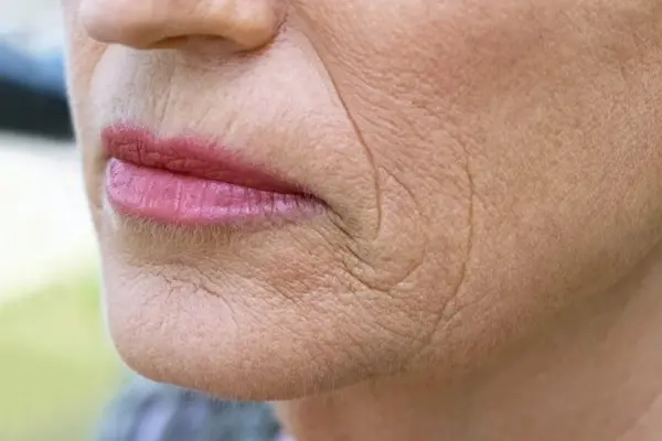 Age & Skin Type