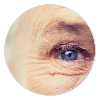 Aging
