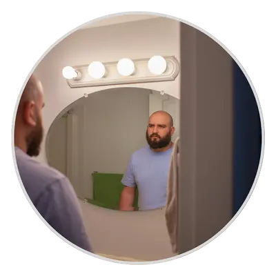 Low Self-Confidence Due to Hair Loss