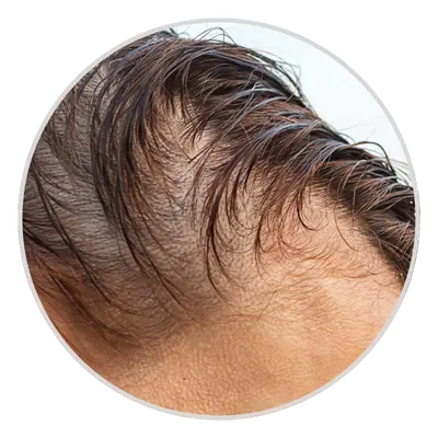 Visible Scalp Through Hair