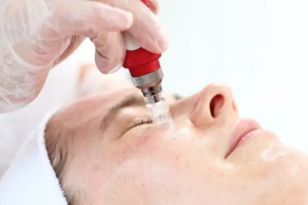 Microneedling with Serums