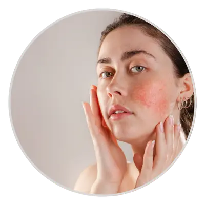 Sensitive skin