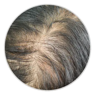 Visible Scalp