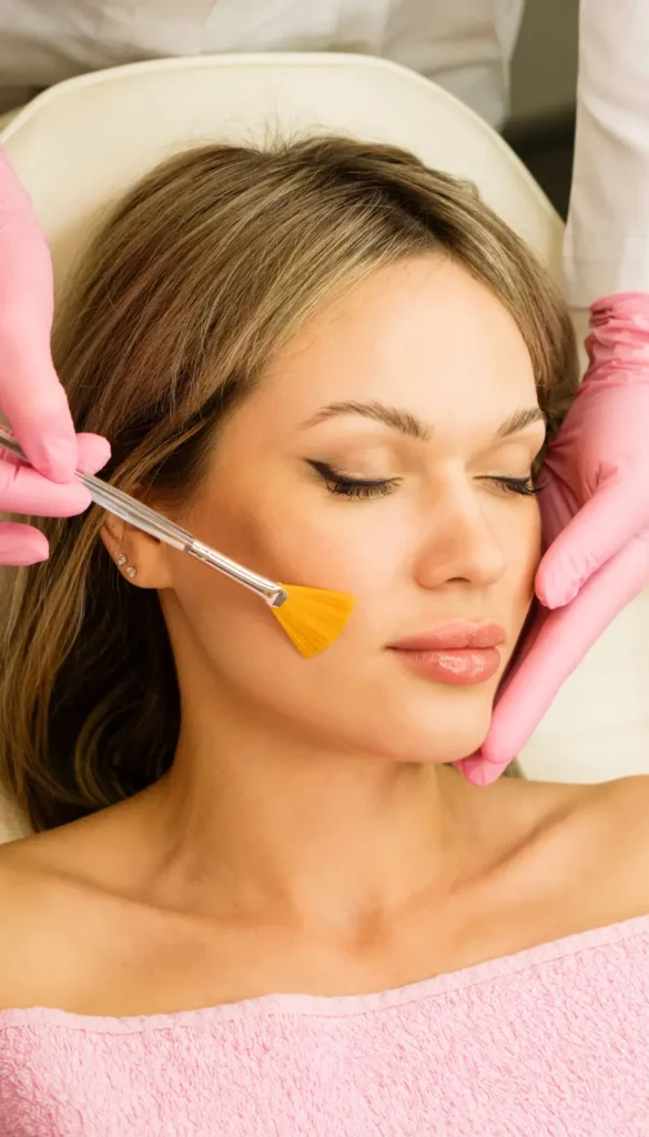 Chemical-peel-process