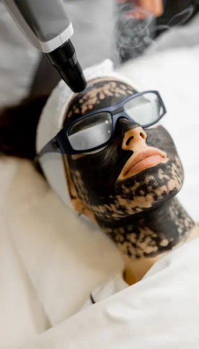 carbon-facial-treatment-process
