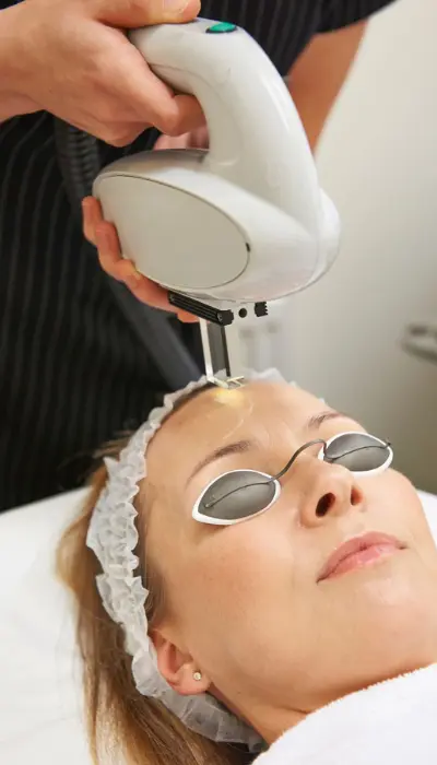 photofacial-treatment-process