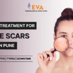 Laser Treatment for Acne Scars Cost in Pune India