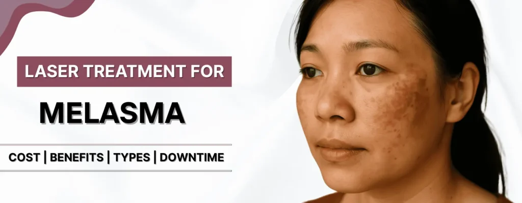 Melasma Treatment cost in Pune
