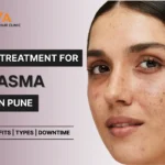 Melasma laser Treatment cost in Pune