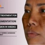 Best Laser Treatment for Skin Pigmentation