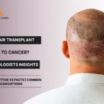 Hair Transplant & Cancer connection