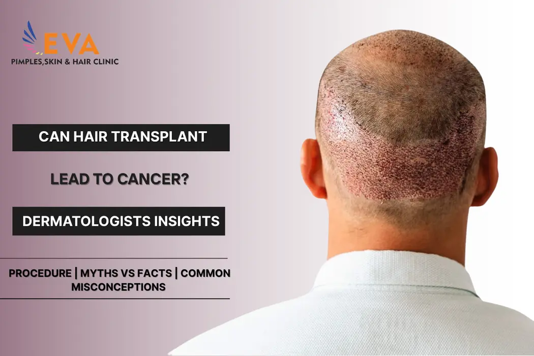 Hair Transplant & Cancer connection