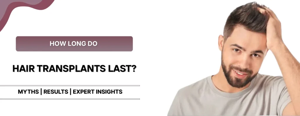 How Long Do Hair Transplants Last