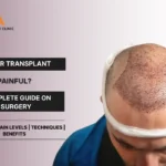 Is Hair Transplant Painful surgery