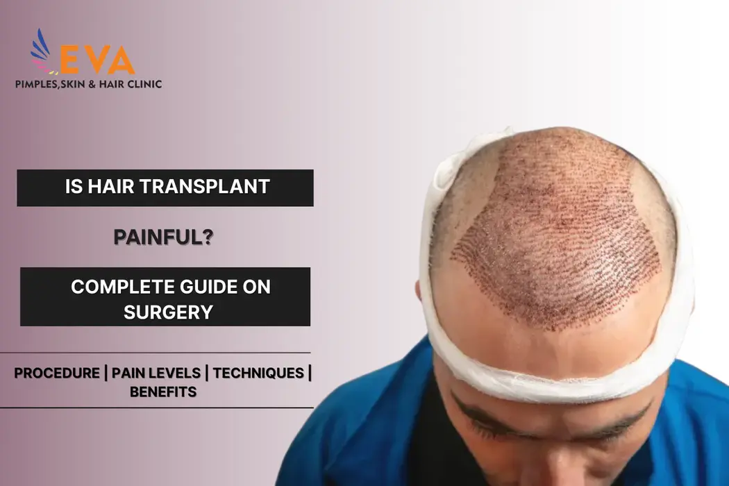 Is Hair Transplant Painful surgery