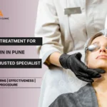 Laser Treatment for Skin