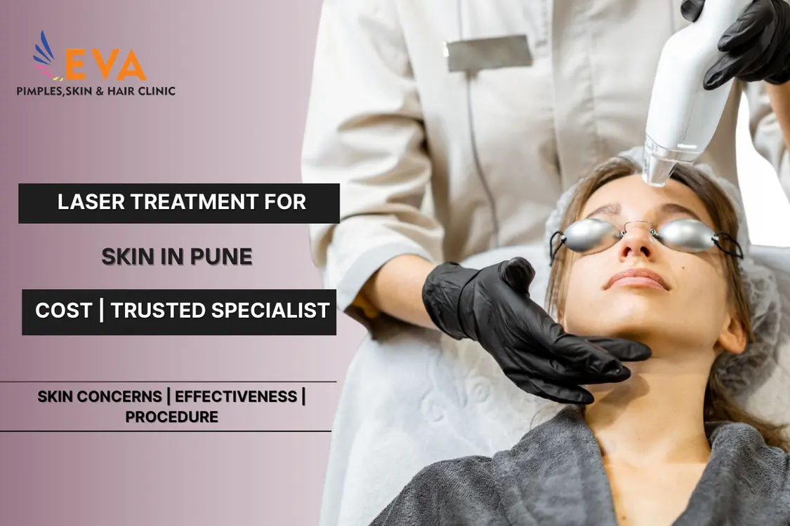 Laser Treatment for Skin