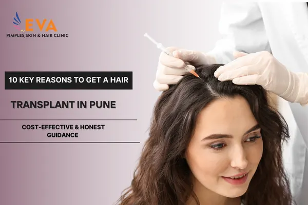 Hair Transplant in Pune