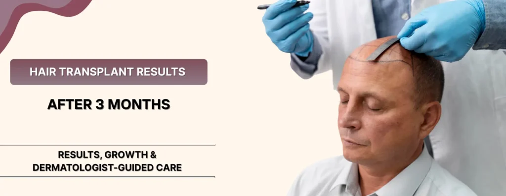 Hair Transplant Results