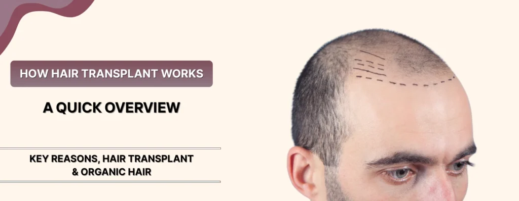 Hair Transplant Results