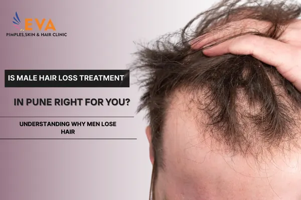 Male Hair Loss Treatment in Pune
