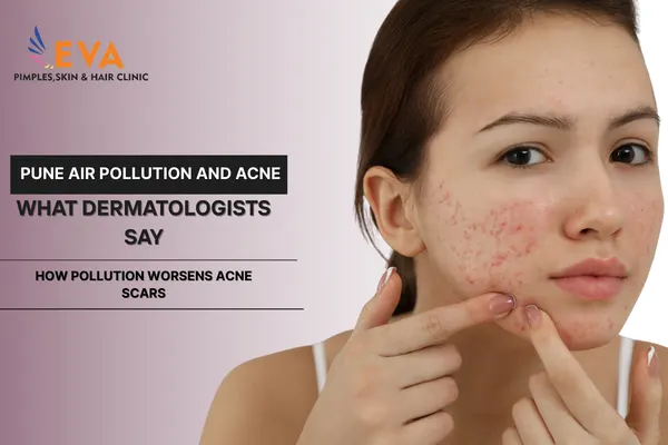 Pune Air Pollution and Acne