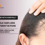 Female Hair Loss Treatment in Pune