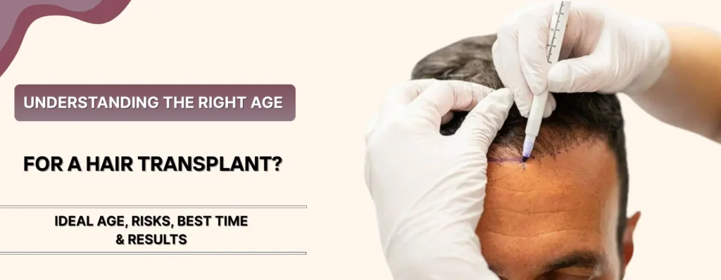 Right Age for a Hair Transplant